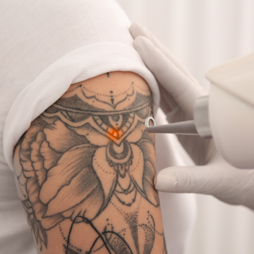 How Tattoo Numbing Creams Work